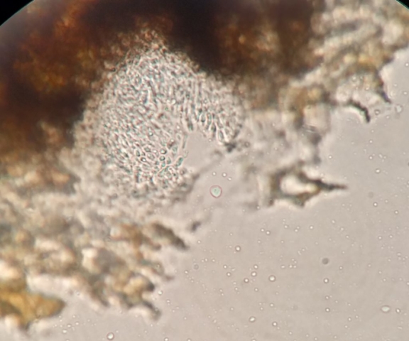 Anisomeridium biforme Pycnidia conidia 1.5μm