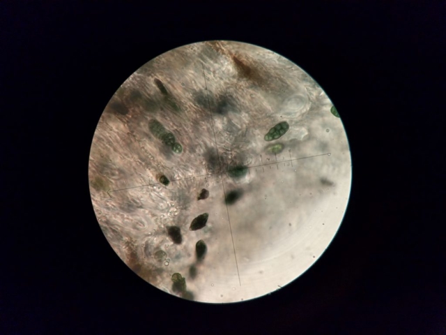 Rhizocarpon lecanorinum muriform spores in K