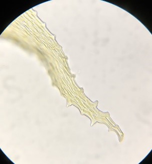 Antitrichia curtipendula - hooked teeth on leaf tips