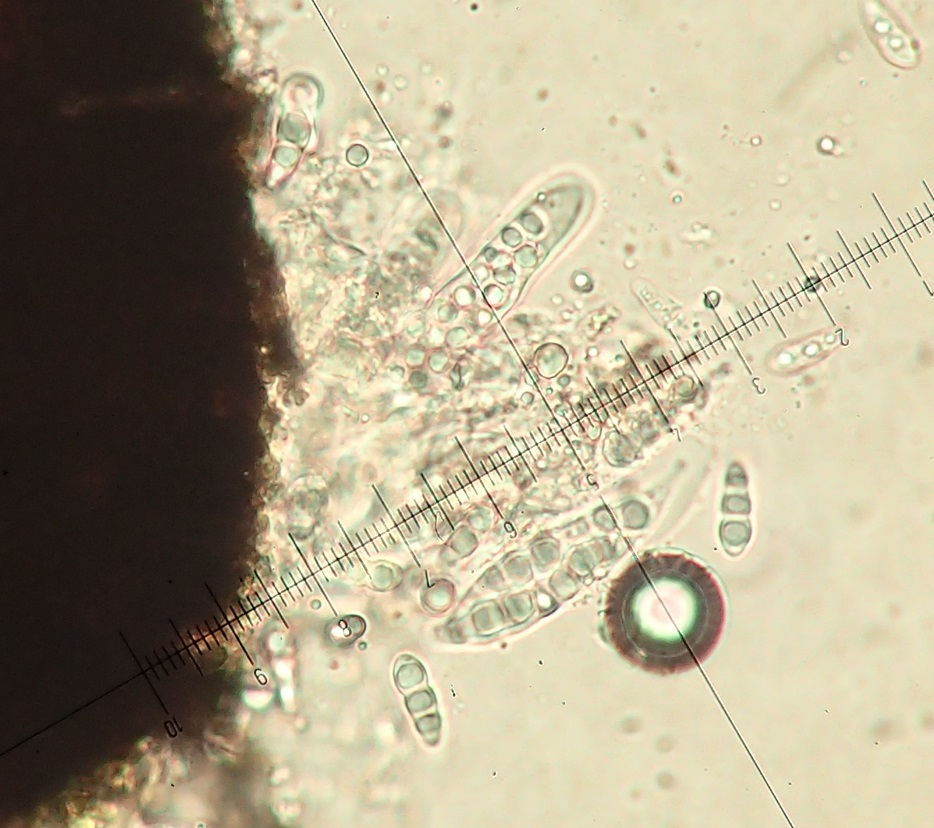 Anisomeridium ranunculosporum spores
