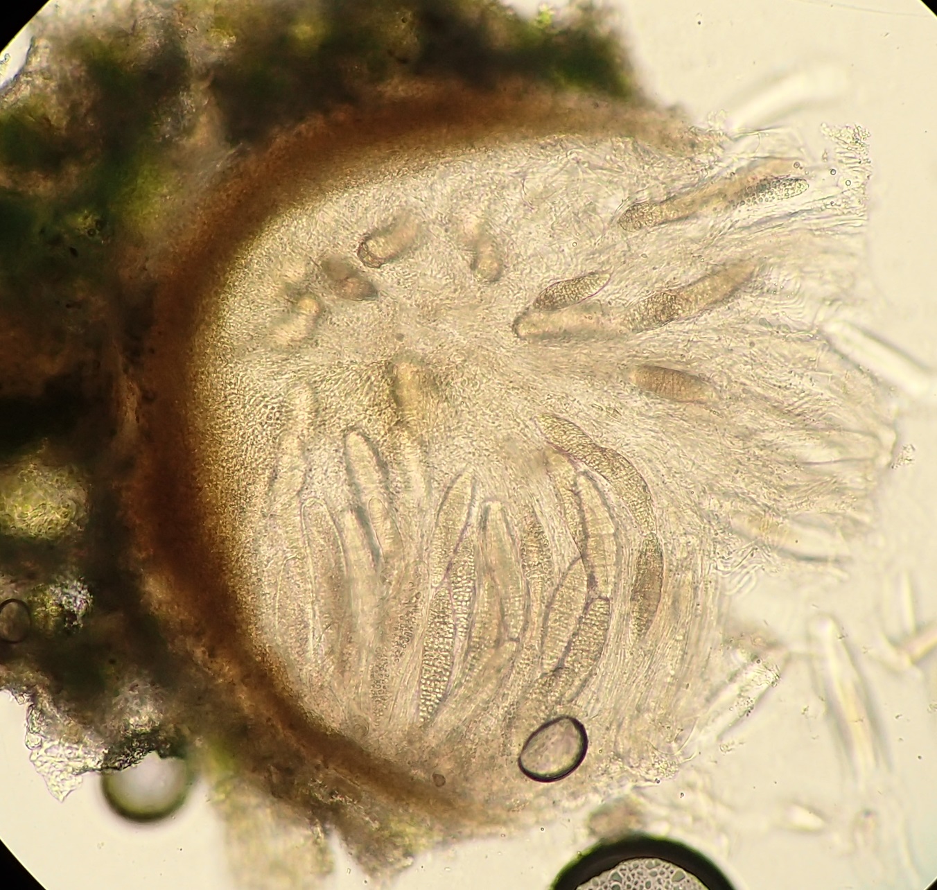 Thelenella muscorum one perithecium with large muriform spores