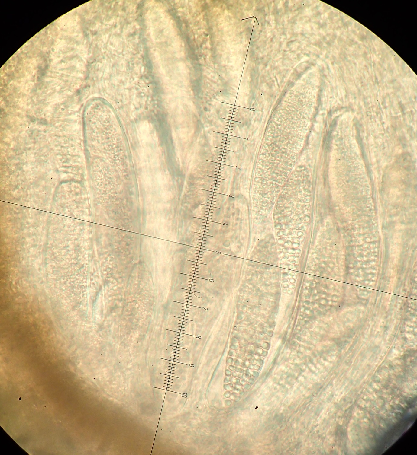 Thelenella muscorum large muriform spores