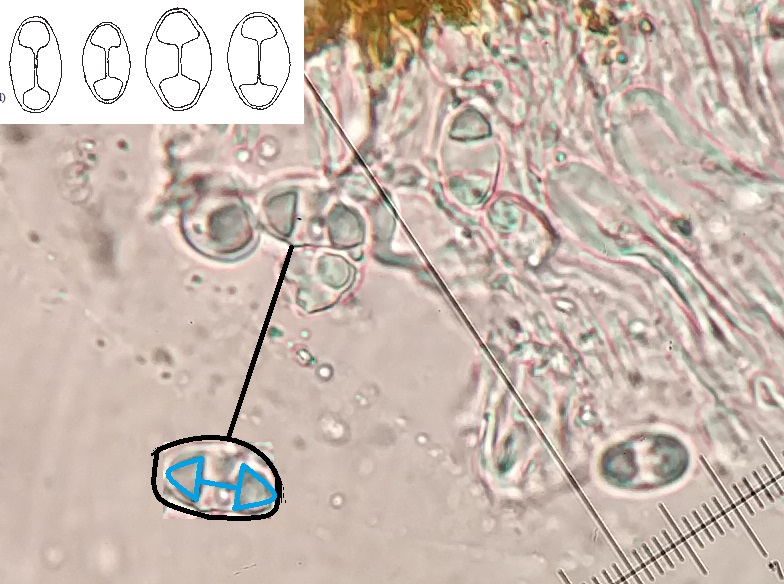 Polarilocular spores of Caloplaca flavovirescens