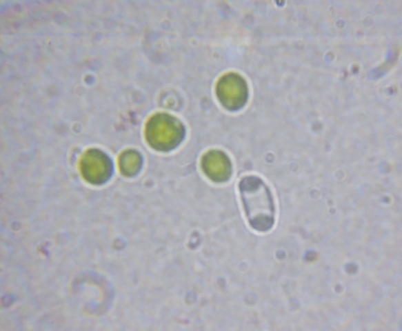Xanthoria algae and a polarilocular spore