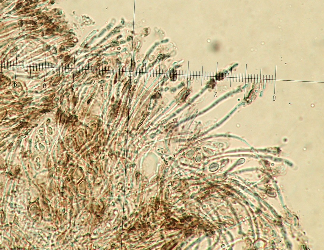 Fuscidea kochiana stained to show septa in paraphysces