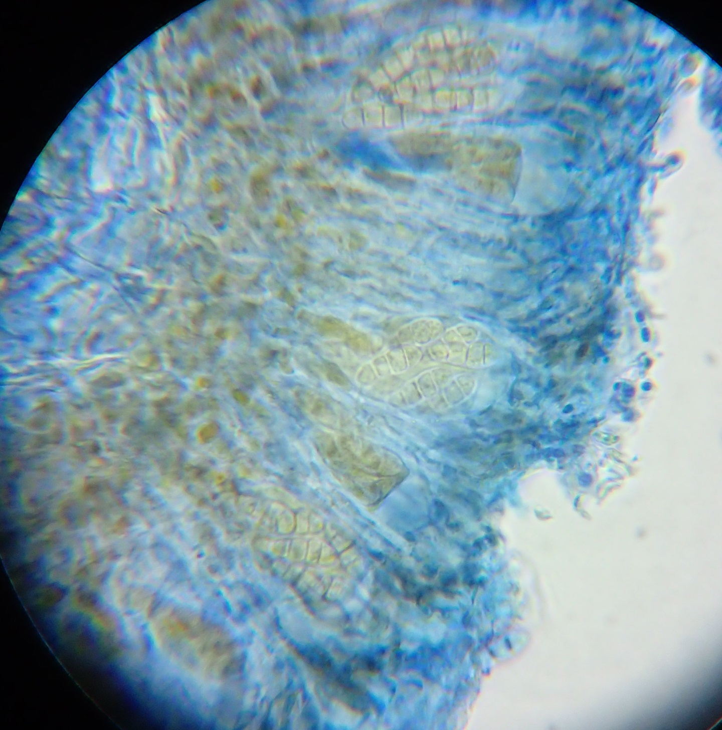 Arthonia radiata: section stained to show spores in asci