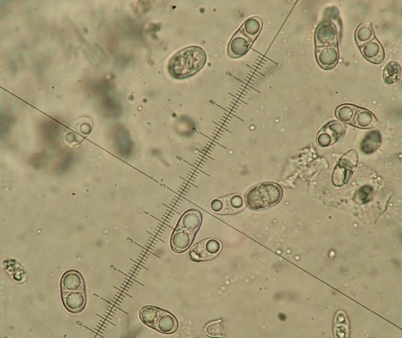 Acrocordia gemmata 1-septate spores