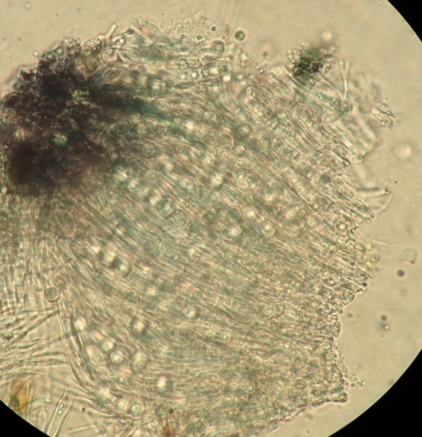 Schaereria cinerorufa: globose spores uniseriate in asci