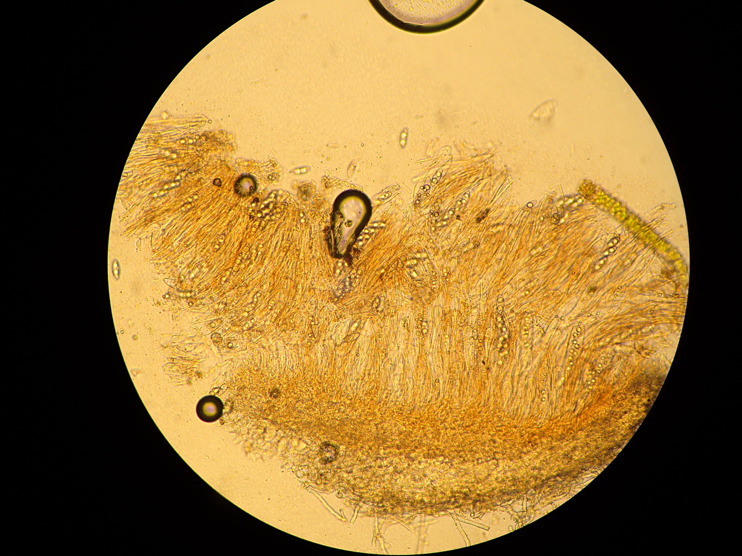 Octospora sp. section of fruit showing spores in asci at x200