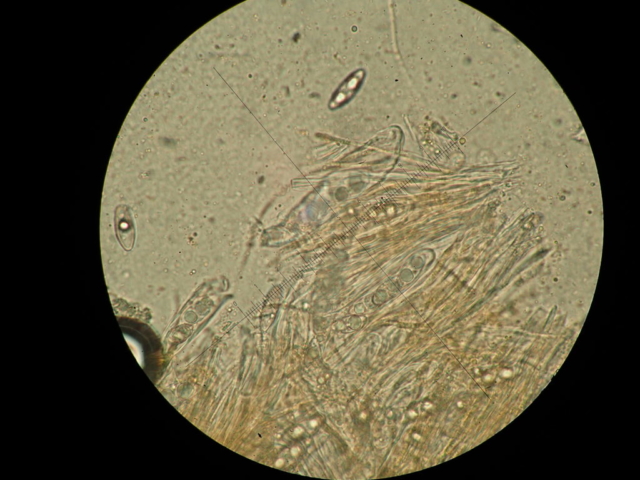Octospora sp. spores in asci at x600