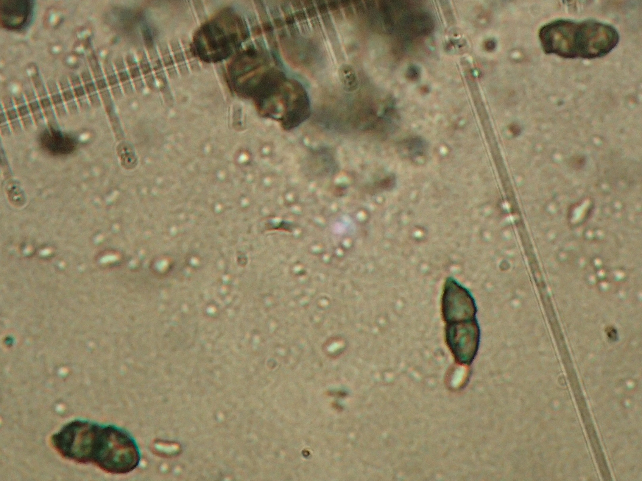 Calicium viride: 1-septate spores