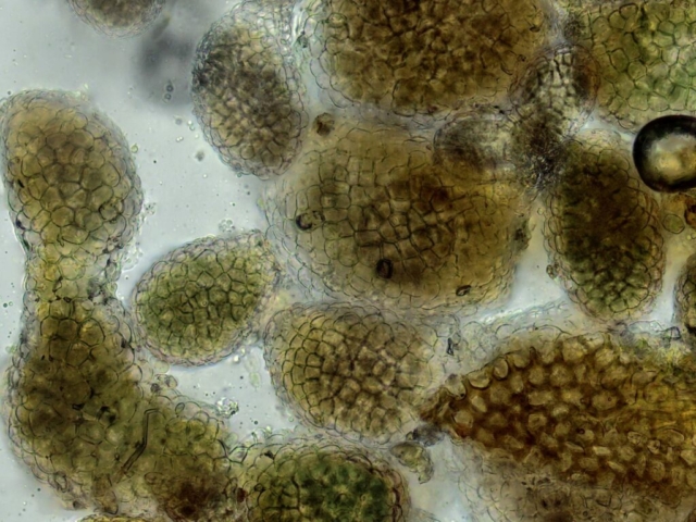 Leptogium terretiusculum viewed under microscope
