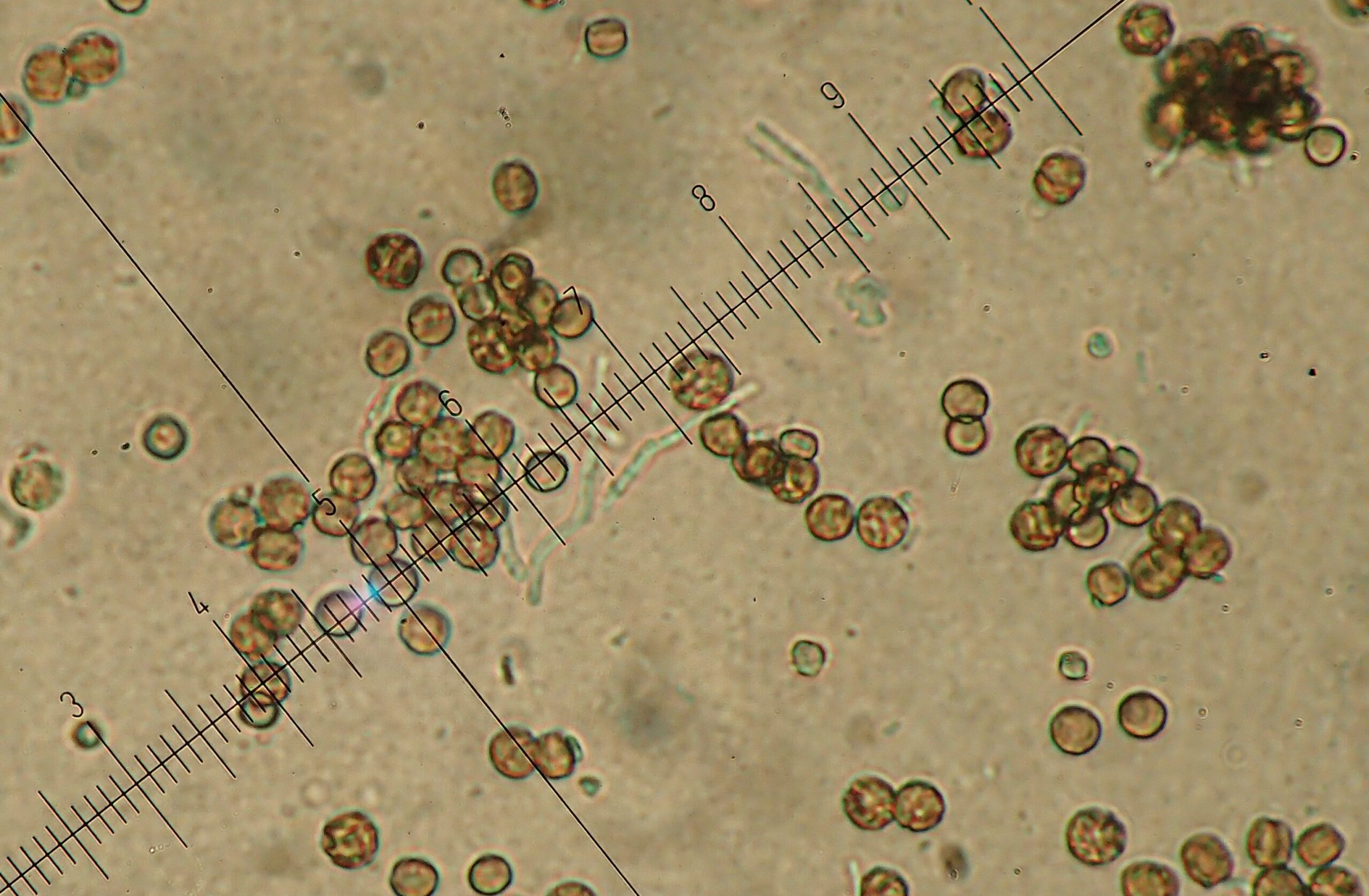 Chaenotheca ferruginea: ornamented globose spores
