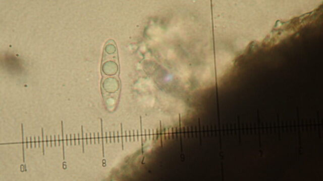 Mycoporum antecellens: spore Mycoporum antecellens: spore