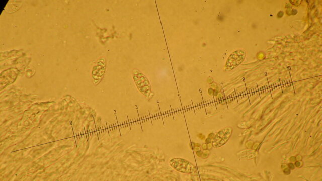 Scytinium subtile: muriform spores Scytinium subtile: muriform spores