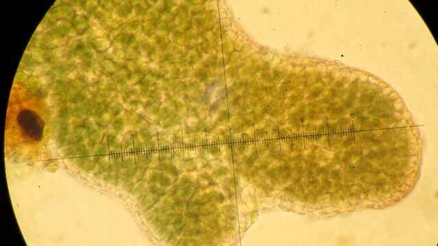 Scytinium subtile: thallus lobe cortex cells Scytinium subtile: thallus lobe cortex cells