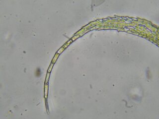 Thuidium assimile leaf tip Thuidium assimile leaf tip