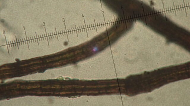 Racodium rupestre - parallel hyphae