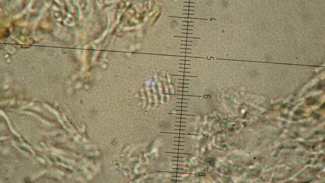 Scoliciosporum umbrinum - spore spirals in an ascus